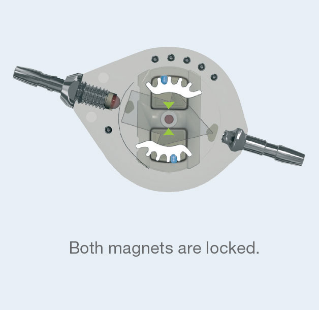 The Polaris® Magnetic Lock both locked from Rycol Medical in Ireland