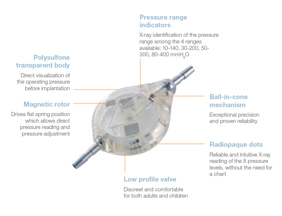 Sophy® Mini SM8® Adjustable Valve  benefits from Rycol Medical in Ireland