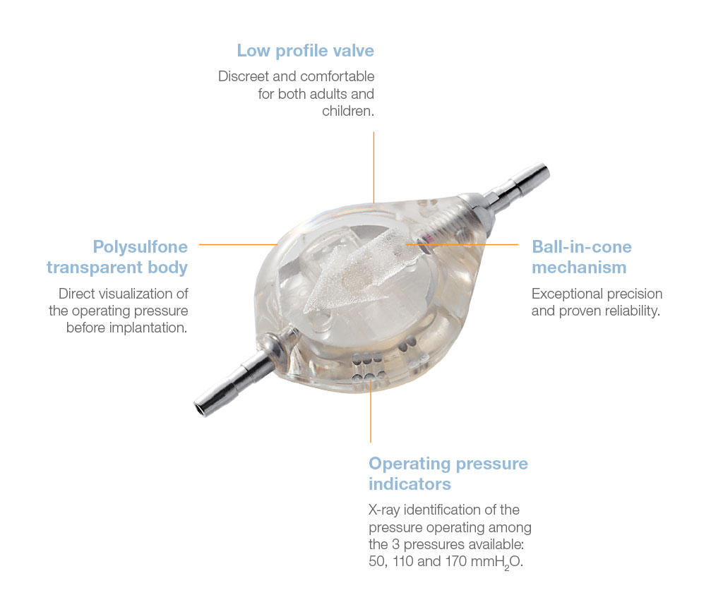 Sophy® Mini SM1® monopressure Valve  benefits from Rycol Medical in Ireland