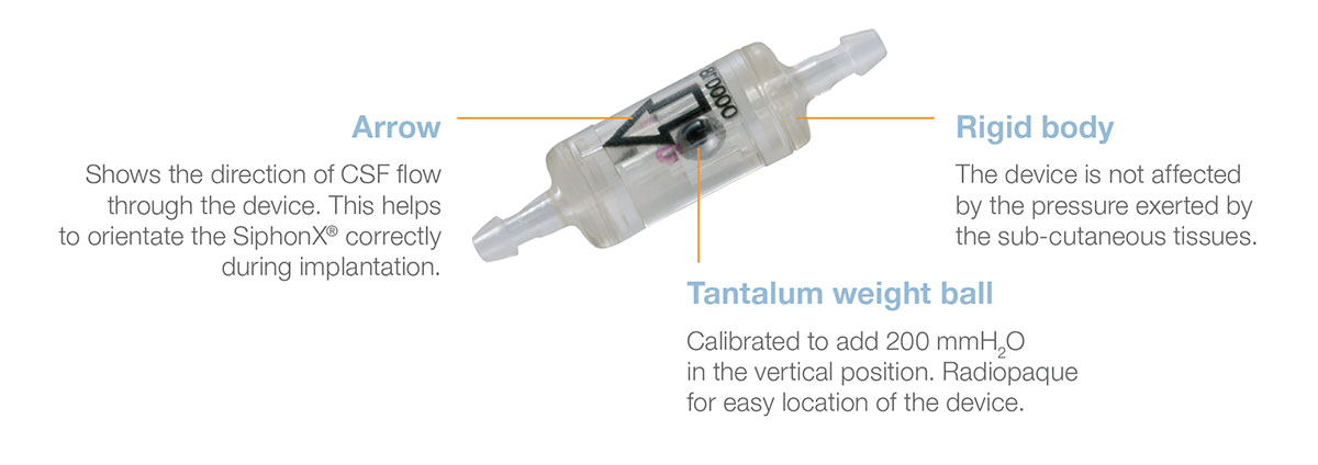 Sophysa SiphonX® Catheter Accessories operating principle from Rycol Medical in Ireland